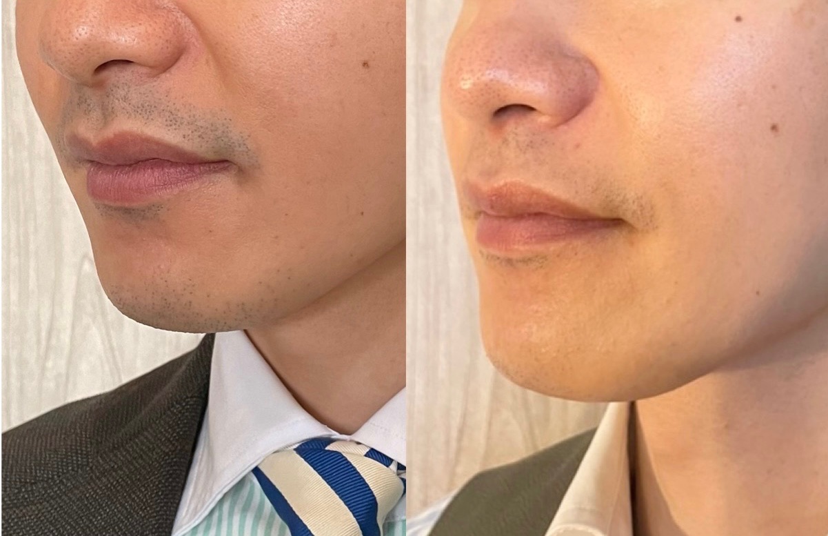 3FABD93B-8F1A-4C19-A730-